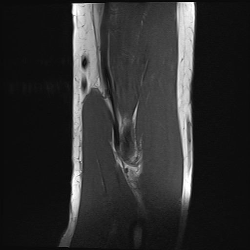 Click on the Serie image to view the images of Wieszt, Gnter